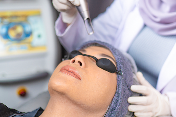 Pico Laser for Acne